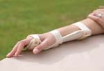 Termoplastik El Bilek Splinti 